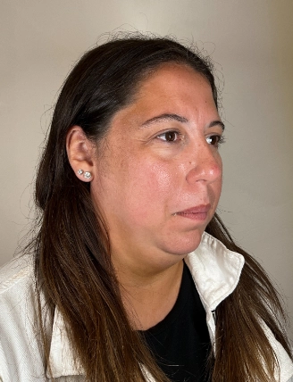 SKINCARECONSULTAFTER2 2