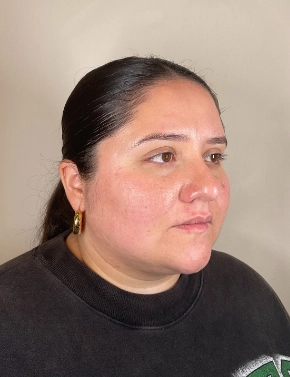 SKINCARECONSULTAFTER3 2